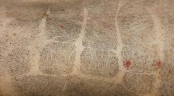 Pirmais teorētiskais un praktiskais pētījums Latvijā par pirkstu nospiedumiem uz miruša cilvēka ādas