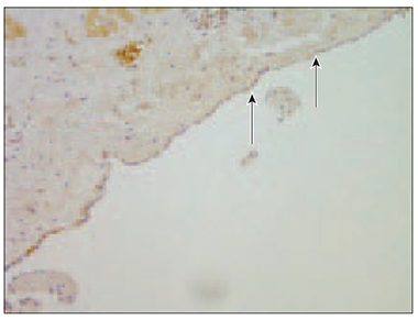 moderate_nucleus_vegf_immunocreative_cells.png