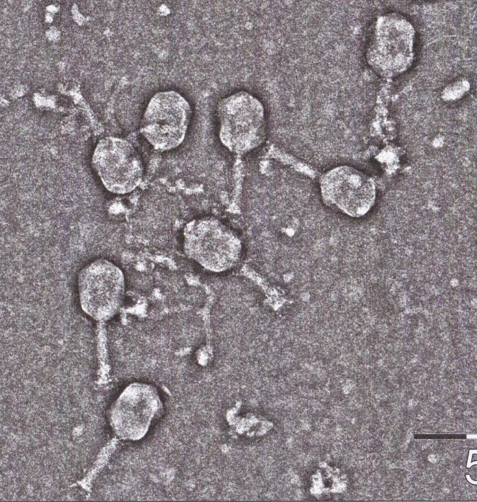 Phages Help When Antibiotics no Longer Work