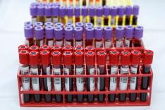 2016. gada 10. novembrī Rīgas Stradiņa universitātē jau otro reizi šajā gadā notika Veselības diena. Tajā RSU studenti un darbinieki ziedoja asinis un pārbaudīja veselību pie topošajiem mediķiem. Thumbnail