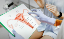 Sabiedrības veselības institūts aicina pieteikties dzemdes kakla vēža prevencijai veltītam vebināram