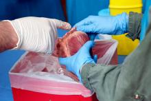 Cardiothoracic surgery