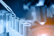 RSU Molekulārās ģenētikas zinātniskā laboratorija veic retas slimības diagnostiku jaundzimušajiem