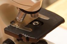 Promocijas darbā pētīts viens no iespējamiem biomarķieriem pārmantotai neiroloģiskai slimībai