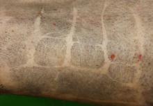 First theoretical and practical study in Latvia on fingerprints on the skin of deceased persons 