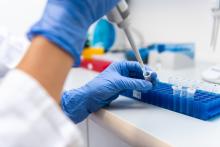 Ķīmiskās vielas mūsu organismā – dalībai pētījumā RSU meklē vīriešus no laukiem un reģionu pilsētām